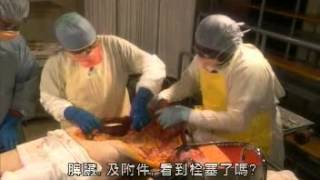 Man Autopsy