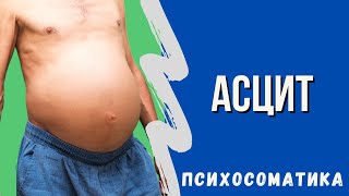 Асцит Психосоматика