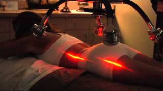 Patient using Zerona Weight Loss Laser  - (no audio) demo presented by  Heal n Cure