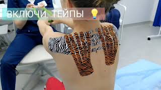 Включи Тейпы?! Головная боль напряжения. Кинезиотейпирование.