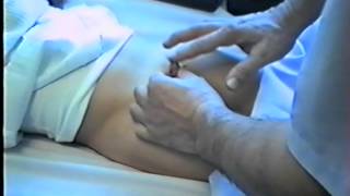 Oбрезание-Circumcision-Циркумцизия