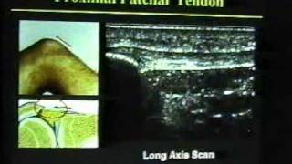 ULTRASOUND OF KNEE JOINT 1