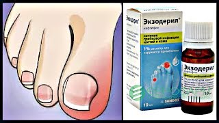 Грибок ногтей и Экзодерил. РЕЗУЛЬТАТЫ моего лечения.
