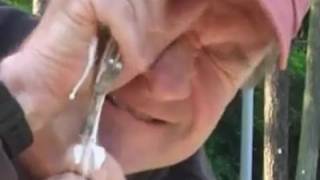 Pus in the Eye Trick