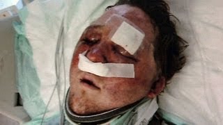 Gay Texas Man, Arron Keahey, Attacked After Using MeetMe App
