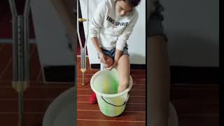 14 year-old Chinese RAK one leg amputee honey girl washing her foot and stump