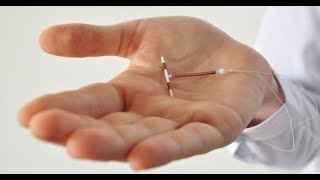 Insersi IUD Pasca Plasenta Pervaginam (Bed Datar) - Hary Tjahjanto - 2009
