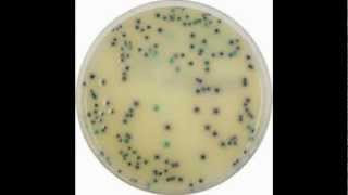 Klebsiella pneumoniae Carbapenemase producing Enterobacteria