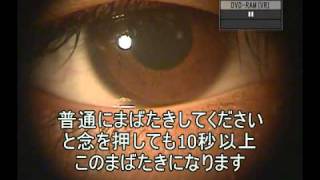18）10歳の女子コンタクトレンズ希望、ドライアイ、瞬目不全