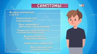 Синдром Кавасаки. Доктор И...
