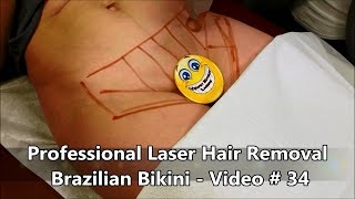 Professional Laser Hair Removal - Brazilian Bikini - Video # 34