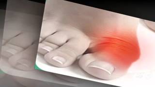 valgus pro отзывы

  - Valgus Pro - Обзор Фиксатора
