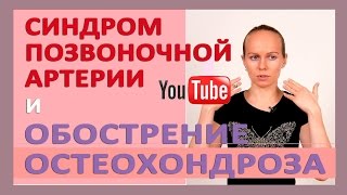 ►Синдром позвоночной артерии и Обострение шейного остеохондроза (симптомы и упражнения)