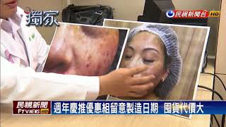 週年慶保養品優惠囤貨  用到過期發炎紅腫－民視新聞