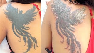 VLOG: MINHA REMOÇÃO DE TATUAGEM