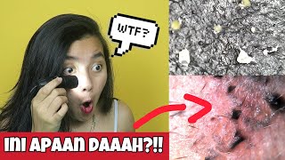 BUSET! Blackhead pore pack pake MICROSCOPE!!! (kalian yang minta?) | Indira Kalistha