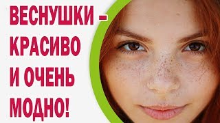 Веснушки – это красиво и очень модно!
