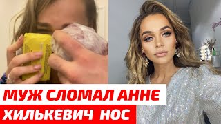 Муж СЛОМАЛ Анне Хилькевич нос в новогоднюю ночь