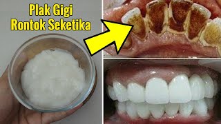 HANYA 2 MENIT… CARA MENGATASI PLAK KUNING PADA GIGI SENDIRI DI RUMAH