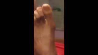 My size 11 foot show