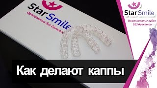 Изготовление капп для зубов. Как производят элайнеры для выравнивания зубов без брекетов. 3d принтер