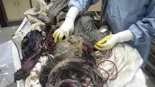 อสุภะกรรมฐาน : ความสกปรกของร่างกาย ชันสูตรศพที่เน่าเปื่อย 3