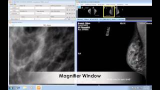 iQ-VIEW DICOM Software Training