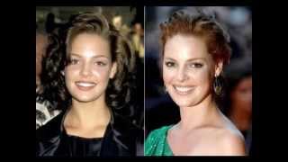 hollywood stars and veneers ( before and after )