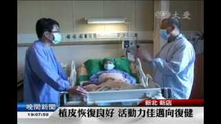 20150713鄭同學轉普通病房 久違愛的抱抱
