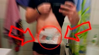 МОЯ ПЕРВАЯ ОПЕРАЦИЯ!