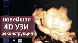 УЗИ исследование. ? Новейшие возможности УЗИ исследования. Моситалмед