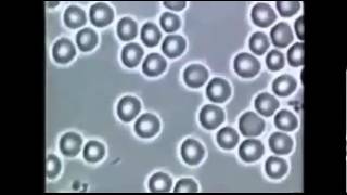 Blood Samples Before   After OPC-3