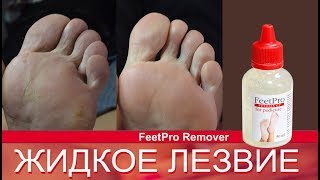 Как правильно использовать жидкое лезвие для педикюра FeetPro? Кислотный педикюр.