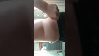Massive fat belly