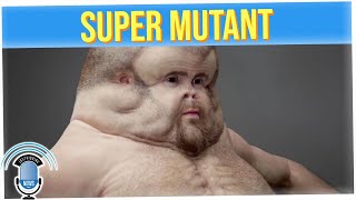 Mutant Superhuman Has a Body That Could Survive Car Crashes