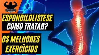 Exercícios Para Aliviar Dor Na Lombar - Tratamento da Esponlilolistese - Canal do Personal