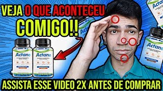 ?Actane - Actane Funciona? Actane Limpa o Rosto? Actane Como Tomar? Actane Onde Comprar?