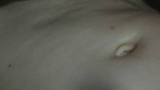 Belly button