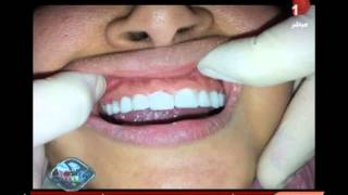 حصريا.. أحدث طرق تجميل وزراعة الأسنان مع الدكتور هشام السباعي والإعلامية ياسمين هنداوي