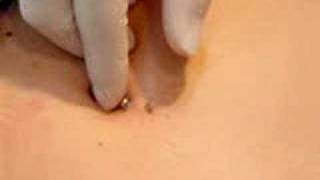 Belly Button