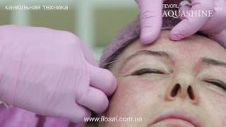 Aquashine BTX канюльная техника [ WorkShop4.me ]
