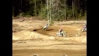 Crash That Broke Left Femur!