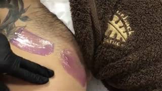 Bikini wax using Outback Opal & Gold Peelable wax