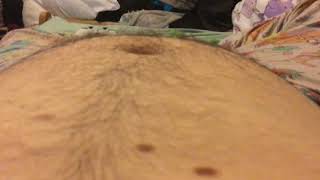 Very fast hiccups