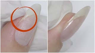 Ремонт сломанного ногтя полигелем (акрилатиком)