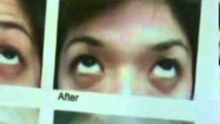 AIM GLOBAL Inc. Perfect-White (Dr. Esteban)