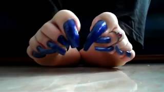 Feet with extremely curved long toenails