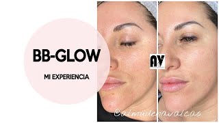 TRATAMIENTO BB GLOW - Mi experiencia, información y opiniones.