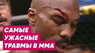 18+ Самые ужасные травмы ММА