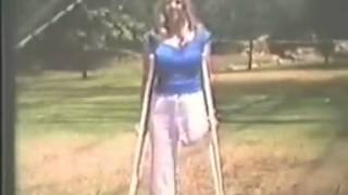 Amputee Woman Rose 3 SAK 1